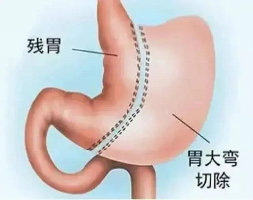 调整大小 3.png