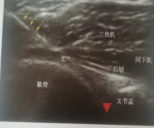 调整大小 3.png