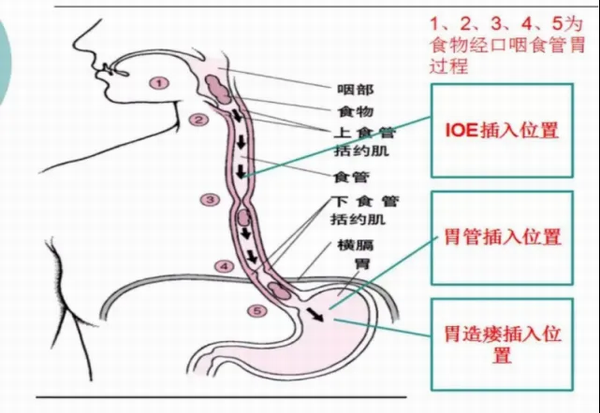 调整大小 1.png